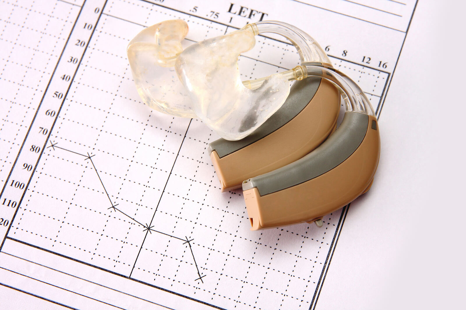 Featured image for “Why DIY Repairs Could Harm Your Hearing Aids”