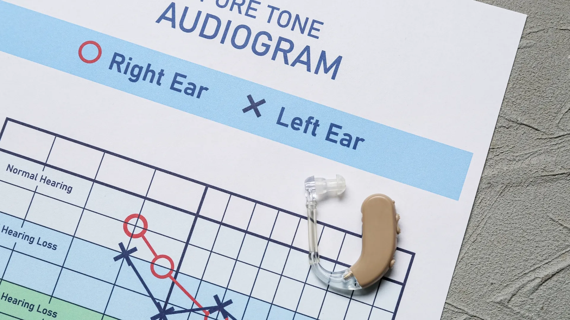 Featured image for “Track Hearing Changes With Hearing Tests”